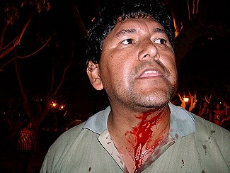 Vecino herido durante la represión en Andalgalá