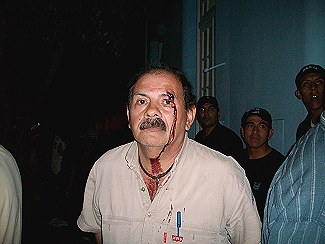 Uno de las decenas de vecinos heridos durante la represión 
