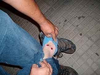 Vecino herido durante la represión en Andalgalá
